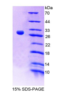 Recombinant Interleukin 9 Receptor (IL9R)