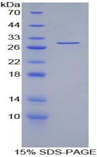 Recombinant Interleukin 2 Receptor Gamma (IL2Rg)