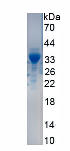 Recombinant Interleukin 1 Receptor Associated Kinase 4 (IRAK4)