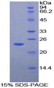 Recombinant Macrophage Stimulating 1 Receptor (MST1R)