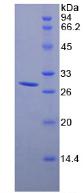 Recombinant Probable ATP-dependent RNA Helicase DDX58 (DDX58)