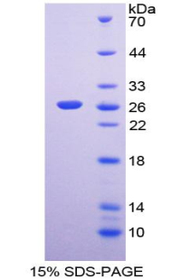 Recombinant Protease, Serine 2 (PRSS2)