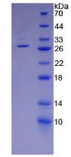 Recombinant Protease, Serine 2 (PRSS2)
