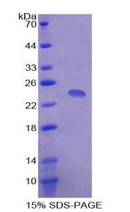 Recombinant Serum Amyloid P Component (SAP)