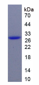 Recombinant Cluster Of Differentiation 147 (CD147)