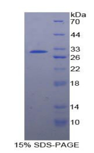 Recombinant Density Enhanced Phosphatase 1 (DEP1)
