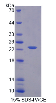 Recombinant Indoleamine-2,3-Dioxygenase (IDO)