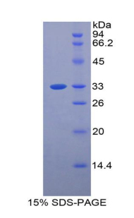 Recombinant Bone Marrow Stromal Cell Antigen 1 (BST1)