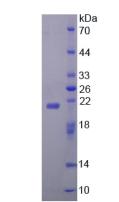 Recombinant Z-DNA Binding Protein 1 (ZBP1)