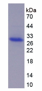 Recombinant A Disintegrin And Metalloprotease 17 (ADAM17)