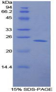 Recombinant Large Multifunctional Peptidase 7 (LMP7)