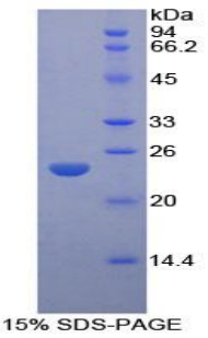 Recombinant Large Multifunctional Peptidase 7 (LMP7)