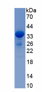 Recombinant Cytochrome P450 Family 21 Subfamily A Member 2 (CYP21A2)