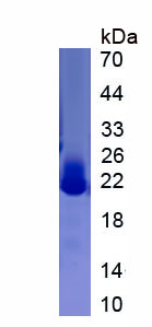 Recombinant Lymphotoxin Beta (LTb)