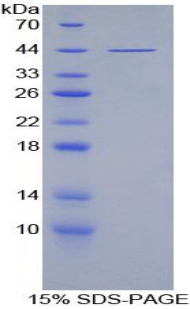 Recombinant Platelet Factor 4 Variant 1 (PF4V1)