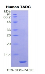 Recombinant Thymus Activation Regulated Chemokine (TARC)