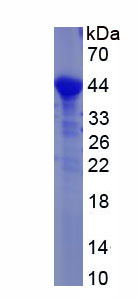 Recombinant Integrin Beta 2 (CD18)