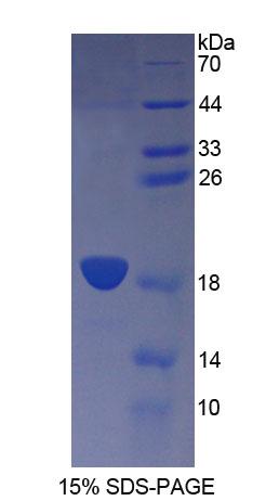 Recombinant Cluster Of Differentiation 164 (C<b>D164</b>)