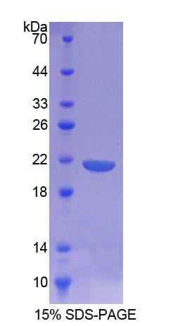 Recombinant Cluster Of Differentiation 164 (C<b>D164</b>)