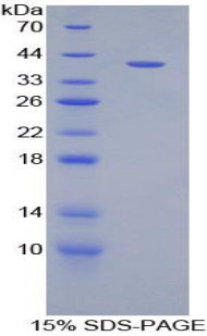 Recombinant Chemokine (C-X-C Motif) Ligand 2 (CXCL2)