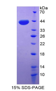 Recombinant Chemokine (C-X-C Motif) Ligand 3 (CXCL3)