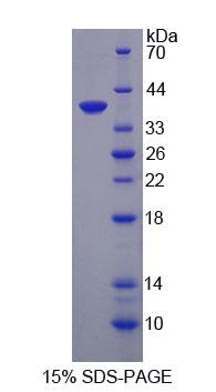 Recombinant Chemokine (C-X-C Motif) Ligand 3 (CXCL3)