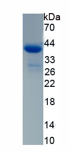 Recombinant Chemokine (C-X-C Motif) Ligand 14 (CXCL14)