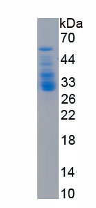 Recombinant Glucocorticoid Receptor (GR)