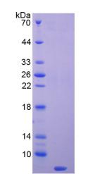 Recombinant Thymosin Beta 4 (TMSB4X)