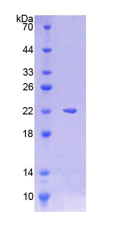 Recombinant Lysosomal Associated Membrane Protein 3 (LAMP3)