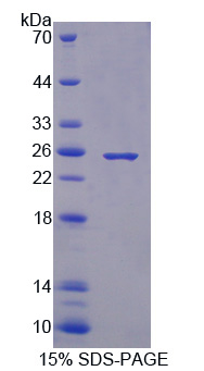 Recombinant Coagulation Factor XIII B Polypeptide (F13B)