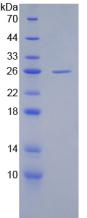 Recombinant Cytosolic Phospholipase A2 (PLA2G4)