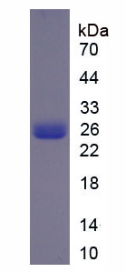 Recombinant Cytosolic Phospholipase A2 (PLA2G4)