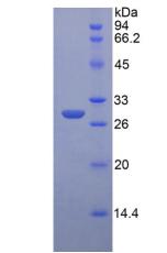 Recombinant Insulin Like Growth Factor 2 Receptor (IGF2R)