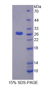 Recombinant Prostaglandin D2 Synthase (PTGDS)