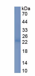 Recombinant Interleukin 13 Receptor Alpha 1 (IL13Ra1)