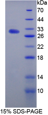 Recombinant Interleukin 17 Receptor A (IL17RA)