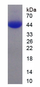 Recombinant Major Basic Protein (MBP)