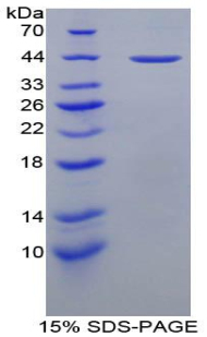 Recombinant Major Basic Protein (MBP)