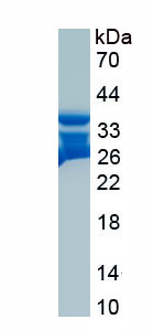 Recombinant Trefoil Factor 3 (TFF3)