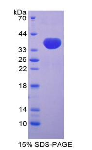 Recombinant Trefoil Factor 3 (TFF3)