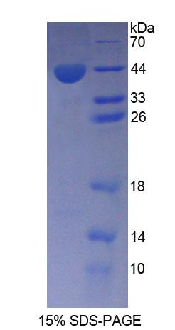 Recombinant Angiotensin II Receptor 1 (AGTR1)