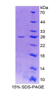 Recombinant Insulin Like Growth Factor 1 Receptor (IGF1R)