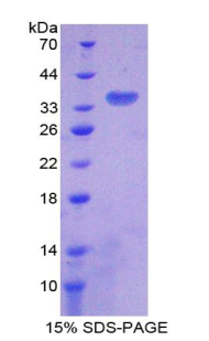 Recombinant Citrate Synthase (CS)