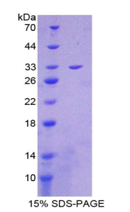 Recombinant Citrate Synthase (CS)