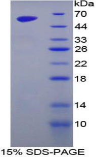 Recombinant Golgi Phosphoprotein 2 (GOLPH2)