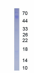 Recombinant Insulin Like Growth Factor Binding Protein 7 (IGFBP7)