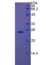 Recombinant Insulin Like Growth Factor Binding Protein 7 (IGFBP7)