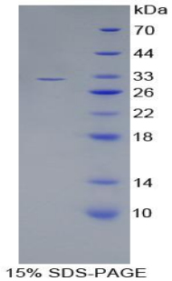 Recombinant Complement Component 1, S Subcomponent (C1s)