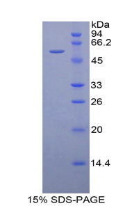 Recombinant Duffy Blood Group Chemokine Receptor (DARC)